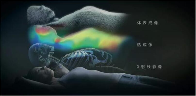 康耐视3D-A5060三维面阵视觉系统助力精准放疗,实现人体定位监控新维度(图3) 康耐视3D-A5060三维面阵视觉系统助力精准放疗,实现人体定位监控新维度(图3)